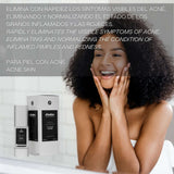Sérum Facial Antiimperfecciones Directo – Acción Intensiva - 30 ml