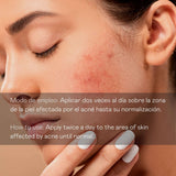 Sérum Facial Antiimperfecciones Directo – Acción Intensiva - 30 ml